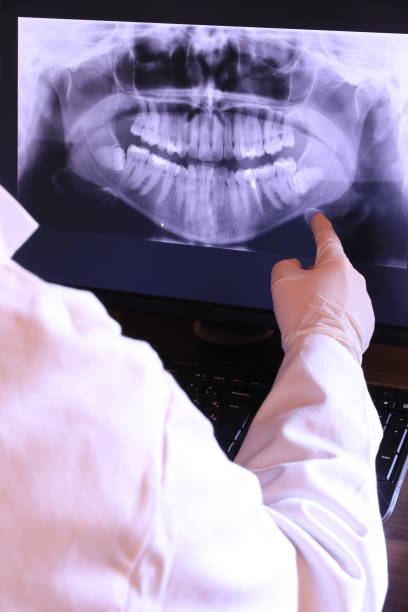 Best Emergency Denture Repair in San Anselmo, CA