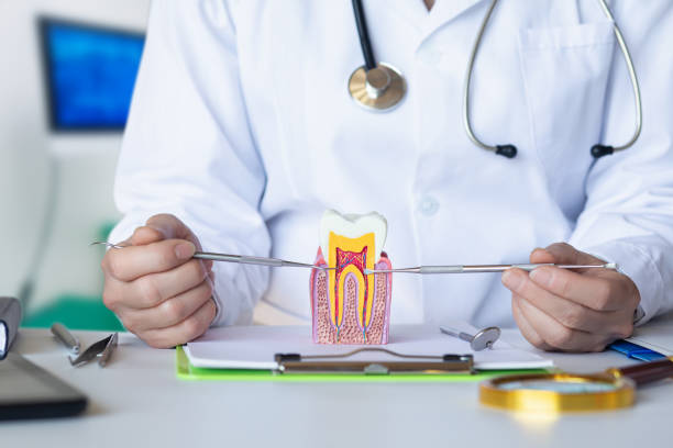Best Urgent Care for Lost Fillings or Crowns in San Anselmo, CA